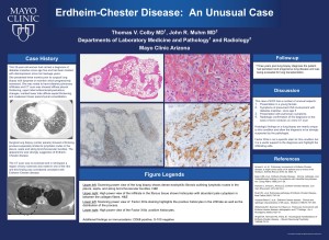 An Unusual ECD Case Report